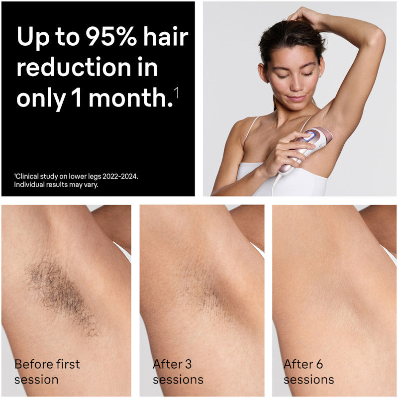 Braun Smart IPL Skin i·Expert Pro 7: At Home Alternative to Laser Hair Removal with 4 Caps Facial Hair Trimmer and Leather Pouch IPL7219