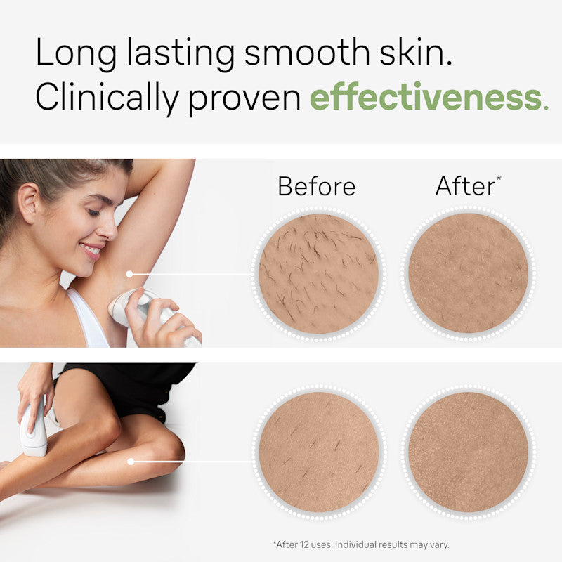 Braun Smart IPL Silk·expert Pro 3: At Home Alternative to Laser Hair Removal for Women and Men At-Home Hair Removal System IPL3020